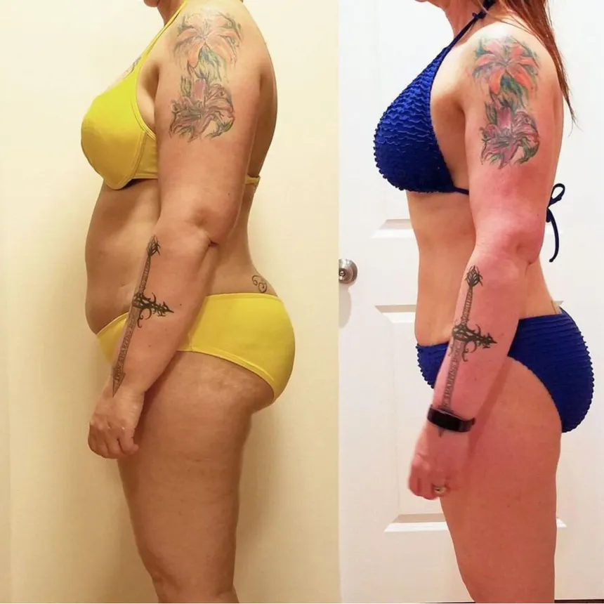 Nicole transformation